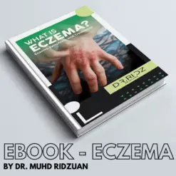 E-BOOK ECZEMA