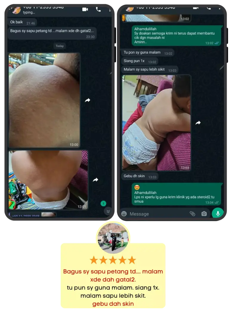 TESTI-DERMCARE-12.webp