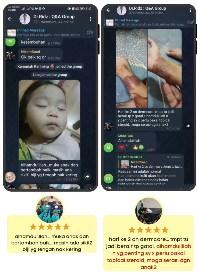TESTI-DERMCARE-15.webp